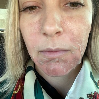 Signature Plastic Surgery - This is what I looked like for a friends wedding - Medical Spas Near Me - Las Vegas, Nevada