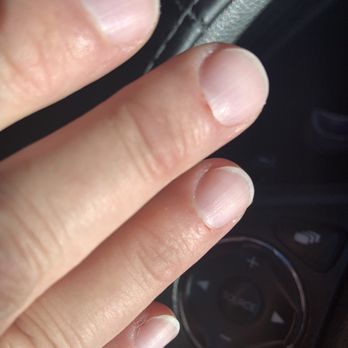 Four Season Nails Salon - Botched Manicure 2 - Nail Salons Near Me - Helena, Montana Four Season Nails Salon - Botched Manicure 2 - Nail Salons Near Me - Helena, Montana