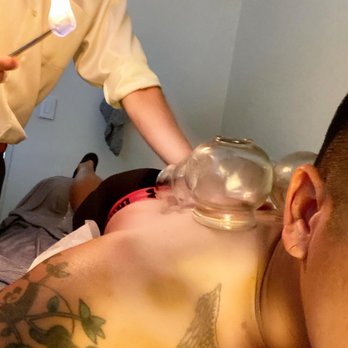 Tripoint Holistic Therapy - Acupuncture Near Me - San Diego, California Tripoint Holistic Therapy - Acupuncture Near Me - San Diego, California