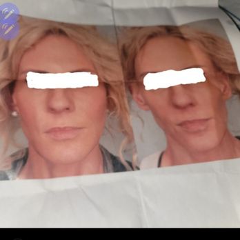Juan Quintero, MD - Cosmetic Surgeons Near Me - Louisville, Kentucky