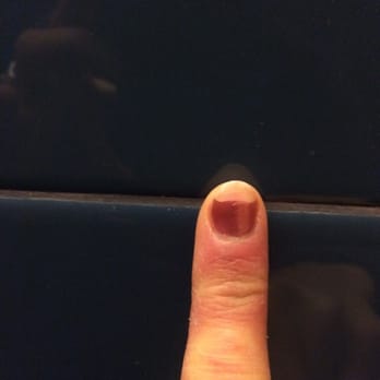 Diamond Nail - Nail after 3 days post manicure - Nail Salons Near Me - Evergreen, Colorado