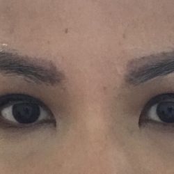 Annise Beauty - Before (with no make up at all, had numbing cream applied already)