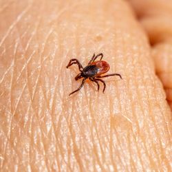 Outbackzack's Pest Removal