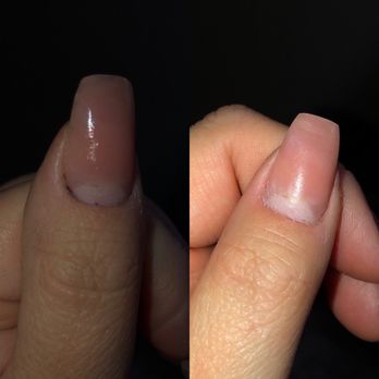 1 Nails - Before (left) and after fixing but before polish (right) - Nail Salons Near Me - Lima, Ohio