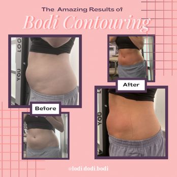 Lodi Dodi Bodi - Body Contouring Near Me Lodi Dodi Bodi - Body Contouring Near Me