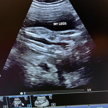 Maternal Love - Ultrasound Imaging Centers Near Me Maternal Love - Ultrasound Imaging Centers Near Me