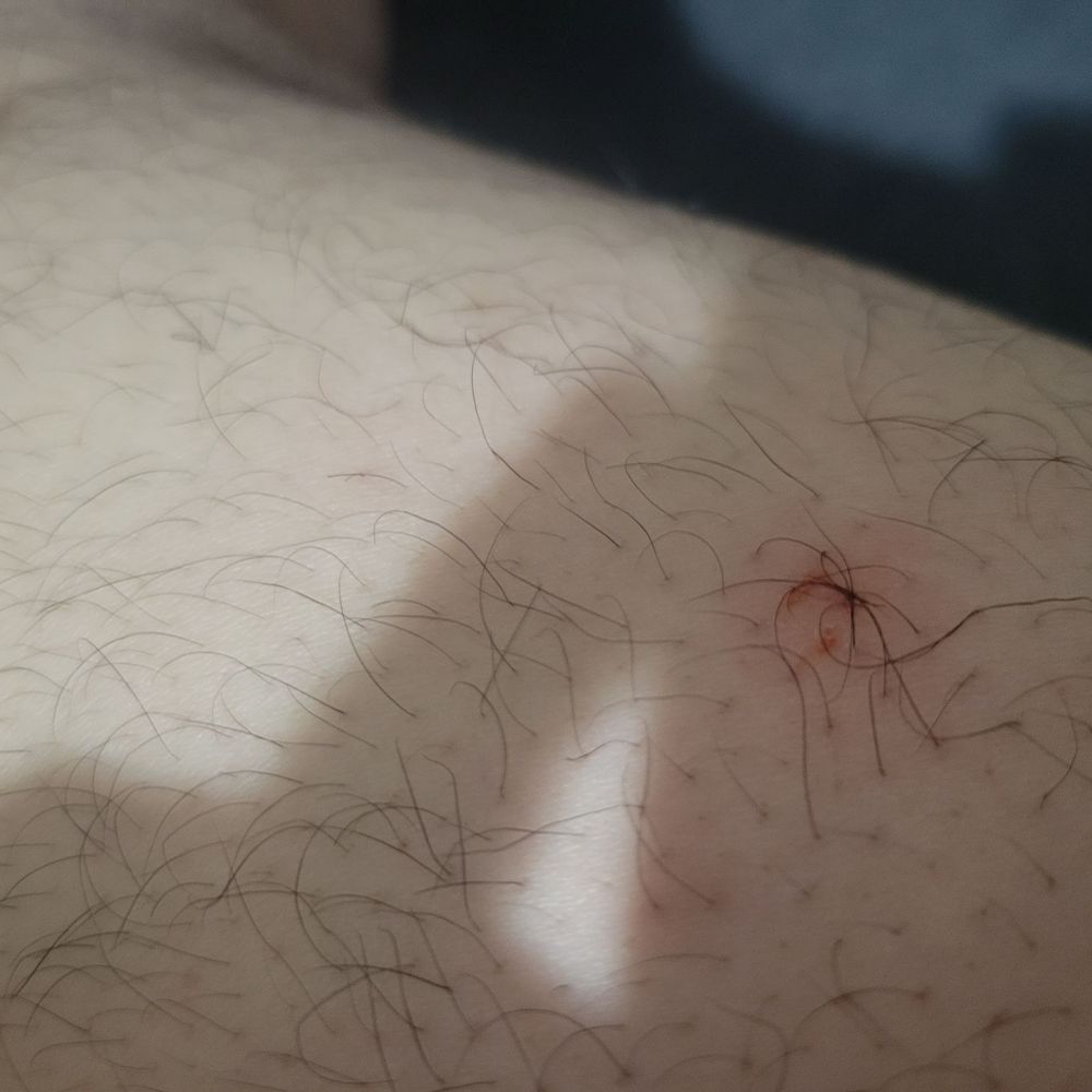 Low Price Auto Glass - Flea bites after visiting their business - Auto Glass Services Near Me - Wilmington, California Low Price Auto Glass - Flea bites after visiting their business - Auto Glass Services Near Me - Wilmington, California