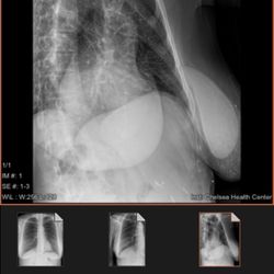 Jeffrey Darrow, M.D - Breast Inplants