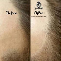 The MicroBlading Guy