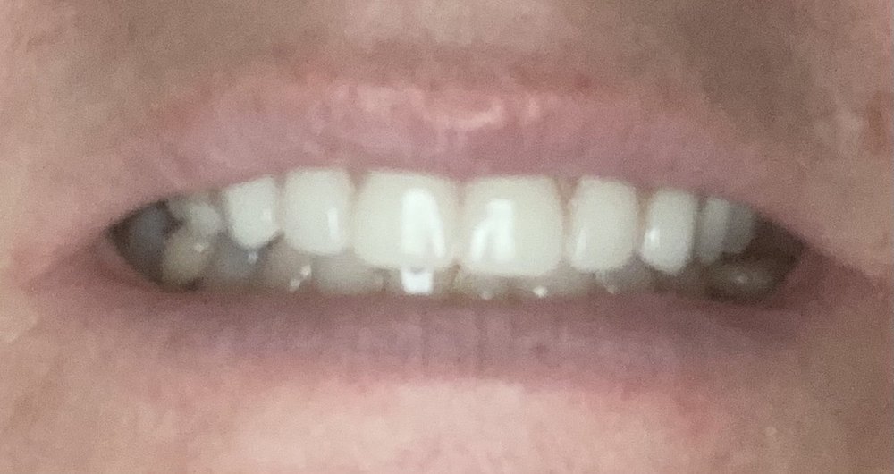 SEACOAST DENTAL IMPLANT & ORAL SURGERY CENTER Updated September 2024