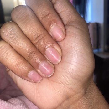 Nails on 9th - ALL MY OF MY NAILS ARE very thin & bendy, my cuticles are red - Nail Salons Near Me - Los Angeles, California Nails on 9th - ALL MY OF MY NAILS ARE very thin & bendy, my cuticles are red - Nail Salons Near Me - Los Angeles, California