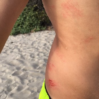 San Onofre State Beach - My son went for a swim and there were rocks in the waves smashing up aging him. Poor guy. - Beaches Near Me - San Clemente, California San Onofre State Beach - My son went for a swim and there were rocks in the waves smashing up aging him. Poor guy. - Beaches Near Me - San Clemente, California