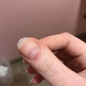 Threading Point Salon - Bleeding cuticle after I washed it in the bathroom :( - Waxing Near Me - Chicago, Illinois