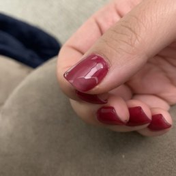 Day 3. And 4 out of 10 nails already look like this. Day 3. And 4 out of 10 nails already look like this.