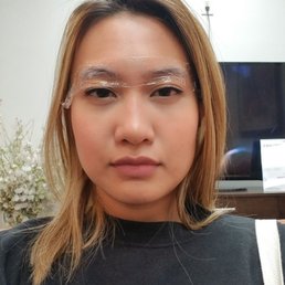 Before (with numbing cream)