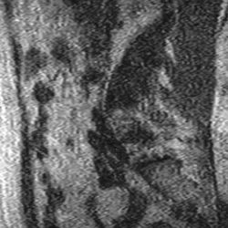 Roseville Diagnostic Imaging - Poor resolution-2 of many