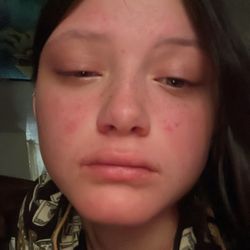 Bonita Brow Bar - my left eye was severely swollen do to the adhesive they had used . which was wig glue. DONT GO HERE EVER.