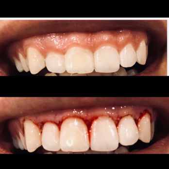 AZ Dental Wellness - Gum contouring that made my smile a million times better! - Cosmetic Dentists Near Me - Scottsdale, Arizona