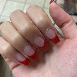 Horrible cuticles, there are weird white lines under the clear Polish on my last two fingers, skin glued to nail Horrible cuticles, there are weird white lines under the clear Polish on my last two fingers, skin glued to nail