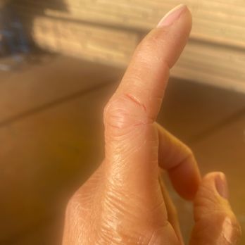 J B Nails - With acetone reaction. I don't know how it get to my skin. It should be only on my nails. Lol - Nail Salons Near Me - Long Beach, California J B Nails - With acetone reaction. I don't know how it get to my skin. It should be only on my nails. Lol - Nail Salons Near Me - Long Beach, California