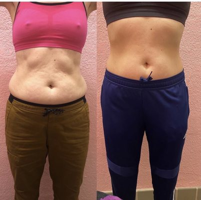 Before & Afters - I've been doing this for 5 years. Reach out today to learn about how you can feel your best while taking the holistic approach!