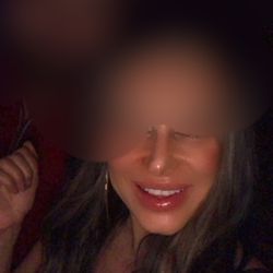 R Laurence Berkowitz, MD - It's funny how my nose won't even look better with a filter