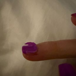 Nail lifting not even 1 week in Nail lifting not even 1 week in