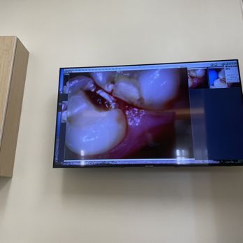 Lakeside Dental Care - Fixing my teath - General Dentistry Near Me - San Francisco, California Lakeside Dental Care - Fixing my teath - General Dentistry Near Me - San Francisco, California