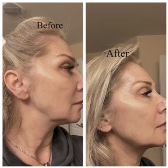 The Moon Beauty - Estheticians Near Me - Great Falls, Virginia The Moon Beauty - Estheticians Near Me - Great Falls, Virginia