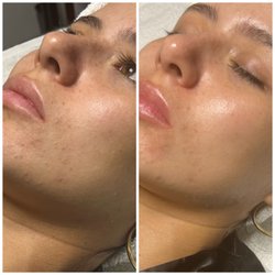 Before & After