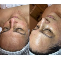 Belle Skin Care