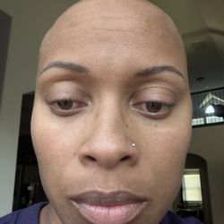 Brow Vixen - Horrible brows and inflamed skin