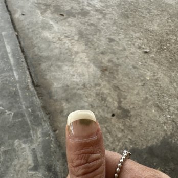 Palace Nails - My Nail turned green &they said I got water under it. I've had nails forever and never had this happen. They refused to make it right - Skin Care Near Me - Lafayette, Louisiana Palace Nails - My Nail turned green &they said I got water under it. I've had nails forever and never had this happen. They refused to make it right - Skin Care Near Me - Lafayette, Louisiana