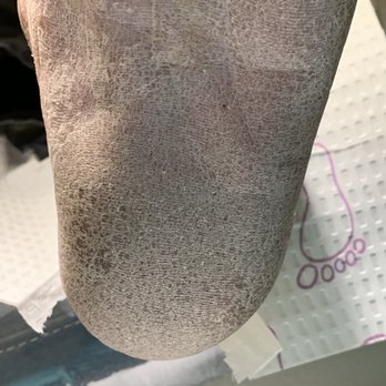 Jacob Foot and Ankle Associates - Podiatrists Near Me - Burlington, New Jersey Jacob Foot and Ankle Associates - Podiatrists Near Me - Burlington, New Jersey