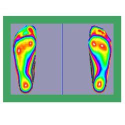 PTI Orthotics & Foot Resource Lab - 3D scanning, non contact-non weight bearing.
