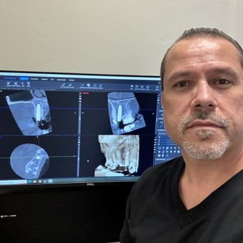 Premier Implant Solutions - Freehanded implant placement - General Dentistry Near Me - Rocklin, California Premier Implant Solutions - Freehanded implant placement - General Dentistry Near Me - Rocklin, California
