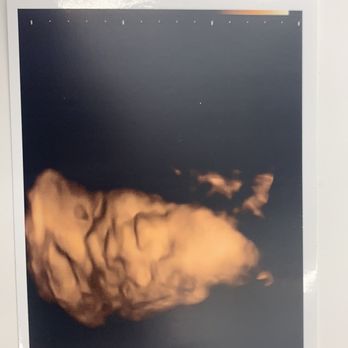 The Baby Connection - Diagnostic Imaging Near Me - Roseville, California