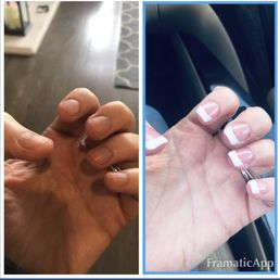Before and after nails Before and after nails
