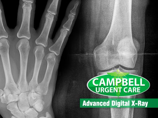 Campbell Urgent Care - patient advocate in Royal Oak, MI