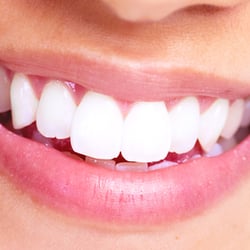 Michael A. Tessier, DDS | Rancho Santa Margarita, CA