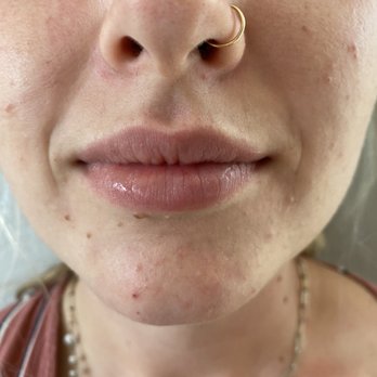 Injection Goddess - Medical Spas Near Me Injection Goddess - Medical Spas Near Me
