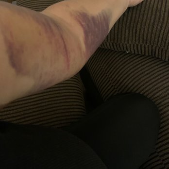 Octapharma Plasma 33 Photos 82 Reviews Blood Plasma Donation Centers 3232 Duke St San Diego Ca Phone Number