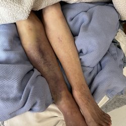 Heritage Gardens Health Care Center - What kind of care is this.... Do NOT leave your loved one here.