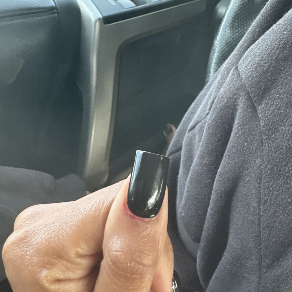 Dried blood on cuticle Dried blood on cuticle