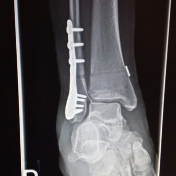 Amory David MD - Dr. Amory is a badass - Orthopedists Near Me - Oceanside, California Amory David MD - Dr. Amory is a badass - Orthopedists Near Me - Oceanside, California