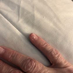 Beautiful Nails & SPA - Pinky nail sliced in halve