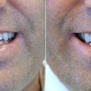 Ian H Rodd, DDS - Cosmetic Dentists Near Me