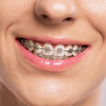Belgrade Dental Associates - General Dentistry Near Me - Belgrade, Montana