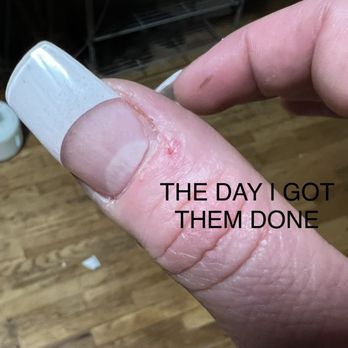 Lovely Nails and Spa - When I got home I realized how much worse they were. The lifting might be a little hard to see but trust me it's on every nail. - Hair Removal Near Me - Seattle, Washington
