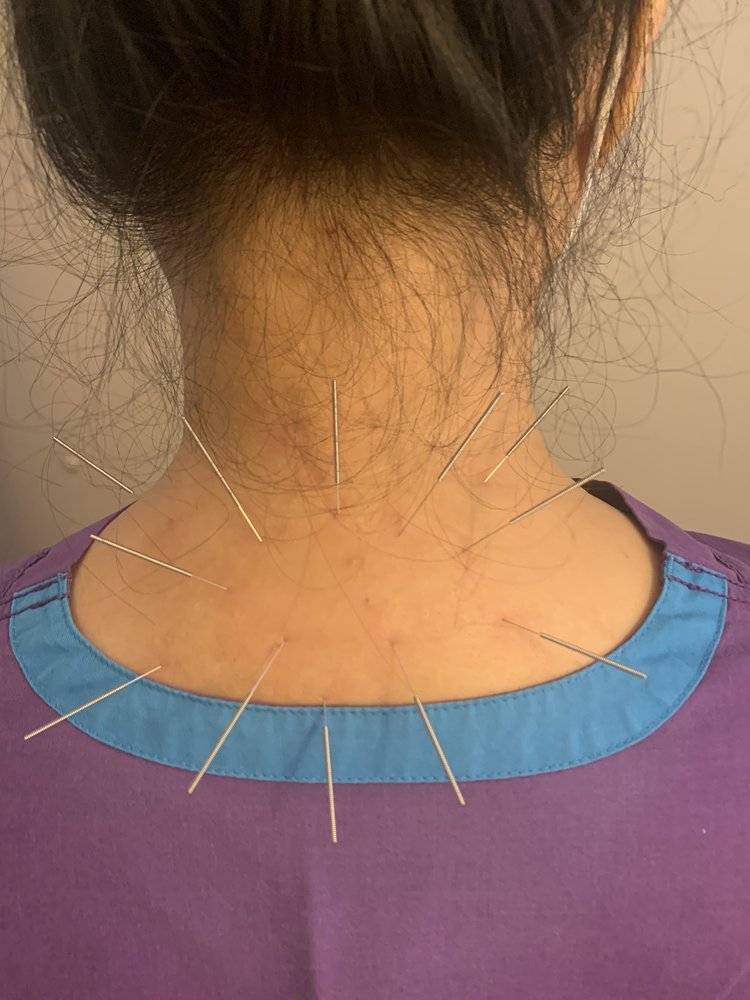 SAN JOSE ACUPUNCTURE & HERB CENTER Updated August 2024 17 Photos